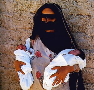 سيدة من العين تزور المستشفى